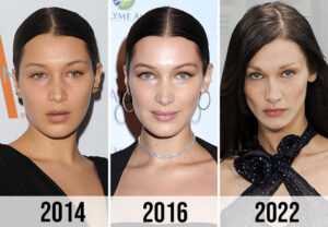 Bella Hadid Before & After Weight Loss